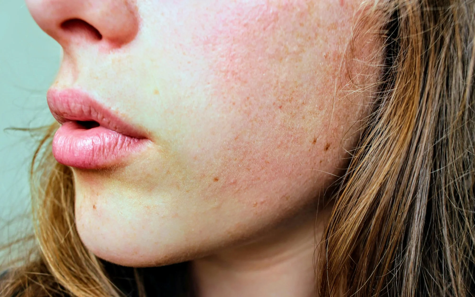 Seasonal Skin Care: How to Prepare Your Skin for Winter 1 Seasonal Skin Care How to Prepare Your Skin for Winter