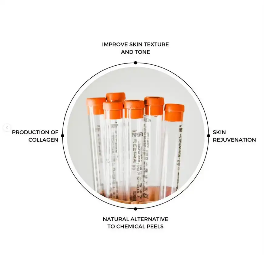 PRP Treatment 1 PRP Treatment