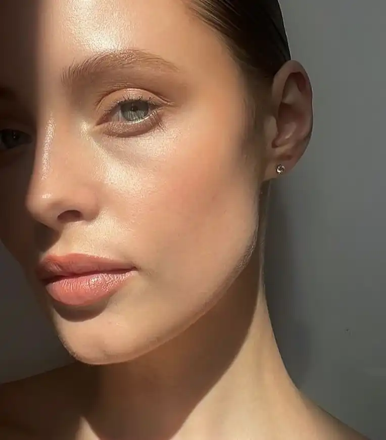 Radiofrequency Microneedling 1 Radiofrequency Microneedling